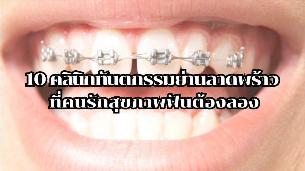 10 คลินิกทันตกรรมย่านลาดพร้าว ที่คนรักสุขภาพฟันต้องลอง